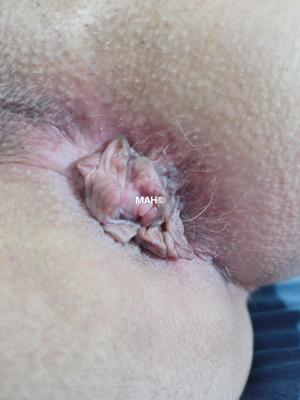 Anus