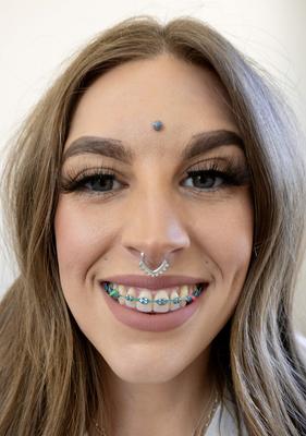 Brace Face Slut 